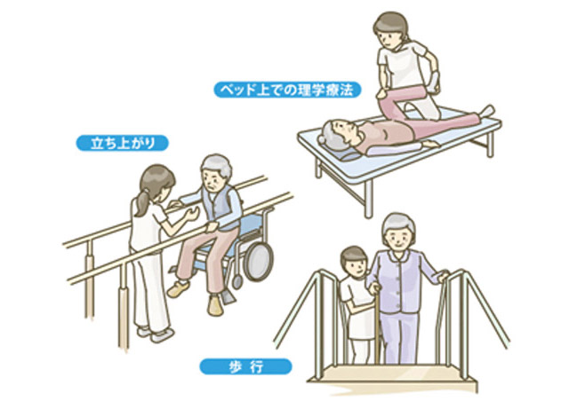 理学療法士のリハビリテーション